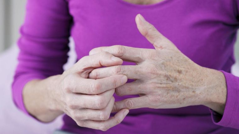 A women with hand osteoarthritis rubs her hands together