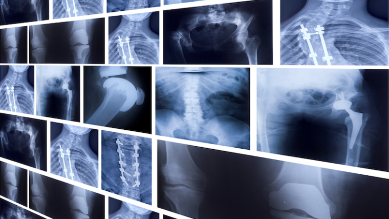 A selection of xrays