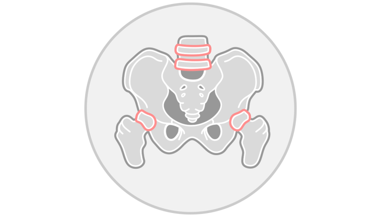 Inflammatory arthritis icon