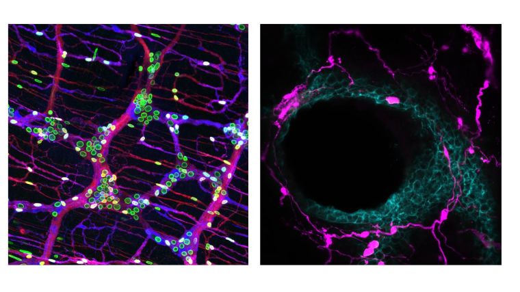 Our research aims to elucidate the role of peripheral glial cells in tissue health and disease.